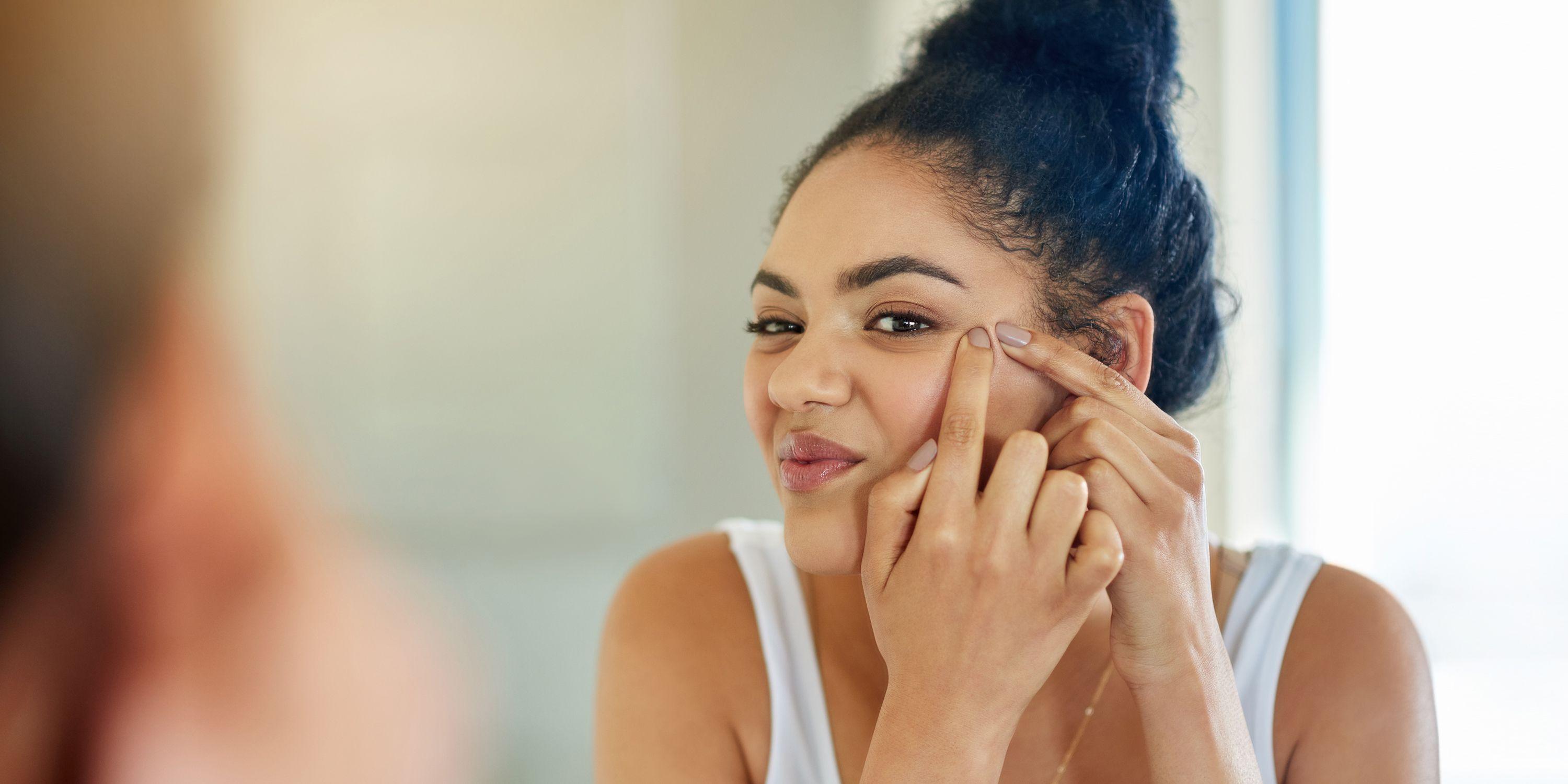 Unveiling Natural Remedies for Common Skin Issues: A Guide by the Best Online Pharmacy in UAE - Wellness Shoppee