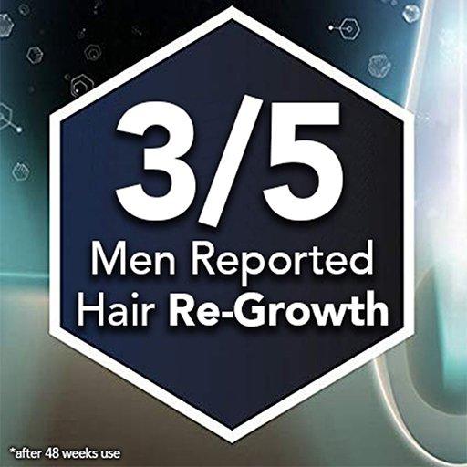 Regaine For Men 5% Minoxidil Topical Hair Regrowth Solution 60ml - Wellness Shoppee